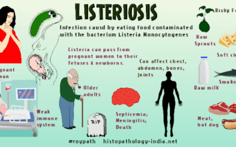 Листериоз у человека причины возникновения симптомы. Инфографика листериоз. Пути передачи листериоза. Listeria monocytogenes рисунок.