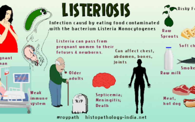 Listeriosis
